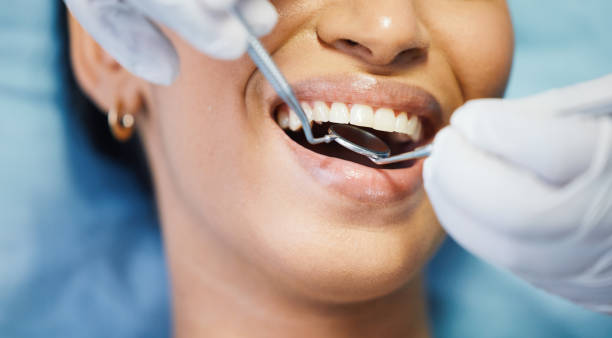 Best Emergency Broken Tooth Repair in Madison, FL