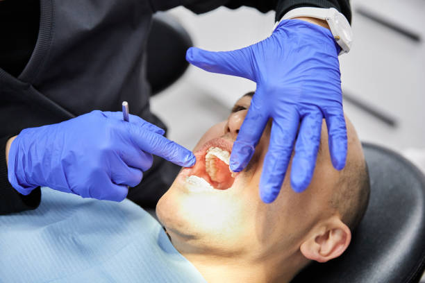Best Emergency Broken Tooth Repair in Madison, FL